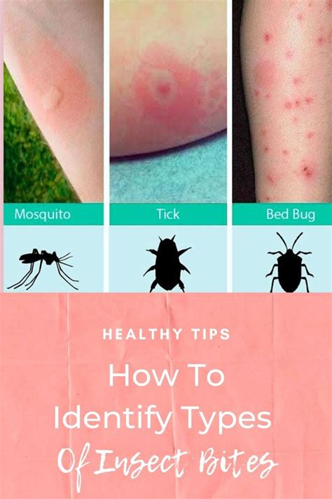 lunettes bites|How to Identify Insect Bites: 12 Bug Bites & Stings .